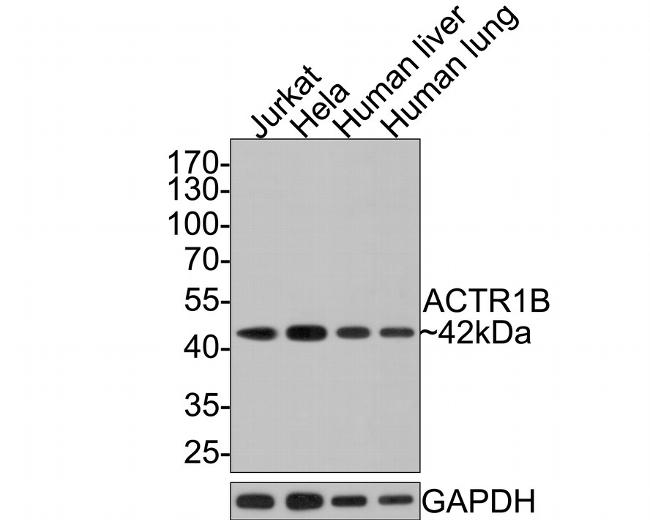 ACTR1B Antibody in Western Blot (WB)