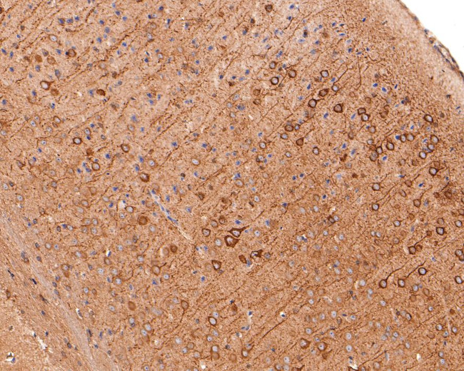 TPMT Antibody in Immunohistochemistry (Paraffin) (IHC (P))