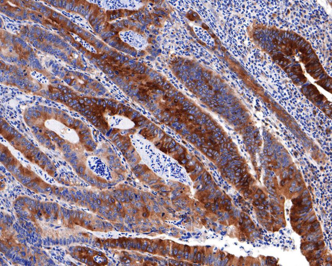 FGFR1OP Antibody in Immunohistochemistry (Paraffin) (IHC (P))