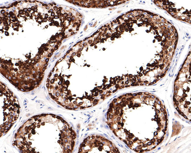 FGFR1OP Antibody in Immunohistochemistry (Paraffin) (IHC (P))