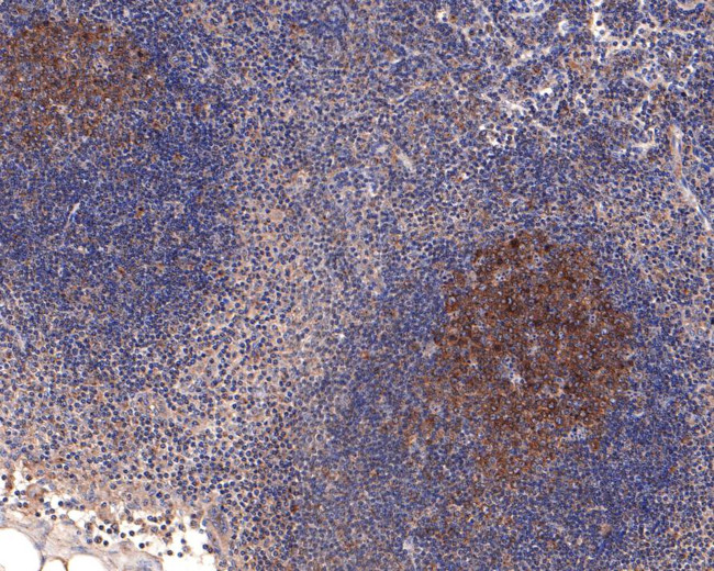 FGFR1OP Antibody in Immunohistochemistry (Paraffin) (IHC (P))