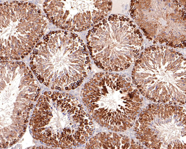 FGFR1OP Antibody in Immunohistochemistry (Paraffin) (IHC (P))