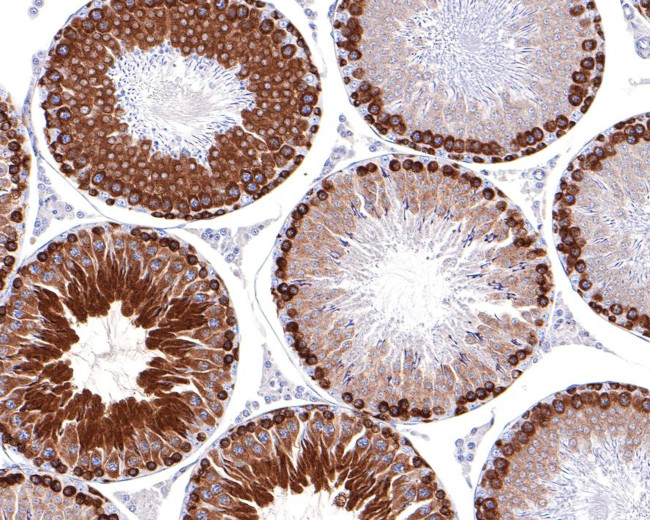 FGFR1OP Antibody in Immunohistochemistry (Paraffin) (IHC (P))