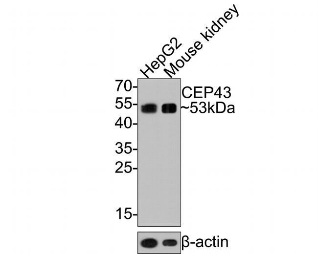 FGFR1OP Antibody in Western Blot (WB)