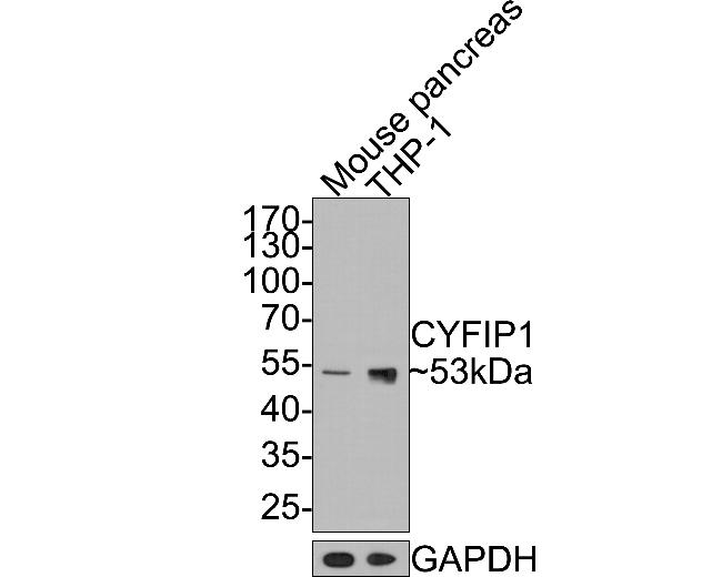 FGFR1OP Antibody in Western Blot (WB)