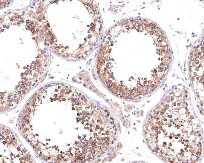 Kinesin 5B Antibody in Immunohistochemistry (Paraffin) (IHC (P))