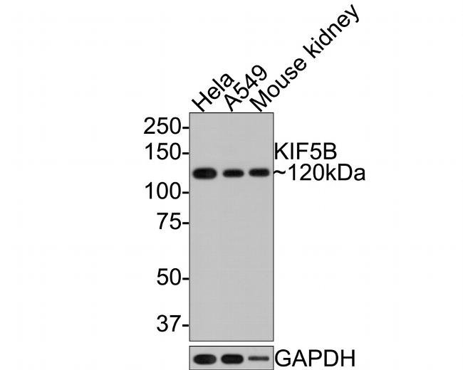 Kinesin 5B Antibody in Western Blot (WB)