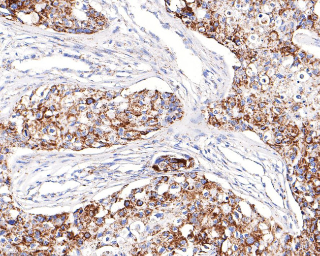 MDH2 Antibody in Immunohistochemistry (Paraffin) (IHC (P))