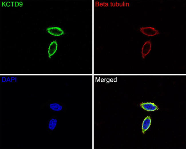 KCTD9 Antibody in Immunocytochemistry (ICC/IF)