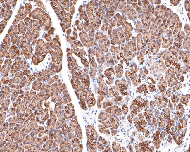 KCTD9 Antibody in Immunohistochemistry (Paraffin) (IHC (P))