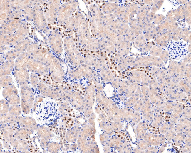 ADSS Antibody in Immunohistochemistry (Paraffin) (IHC (P))