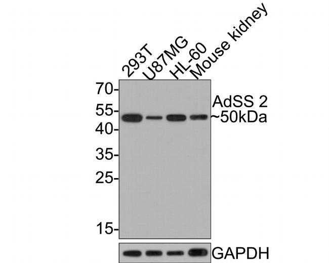 ADSS Antibody in Western Blot (WB)