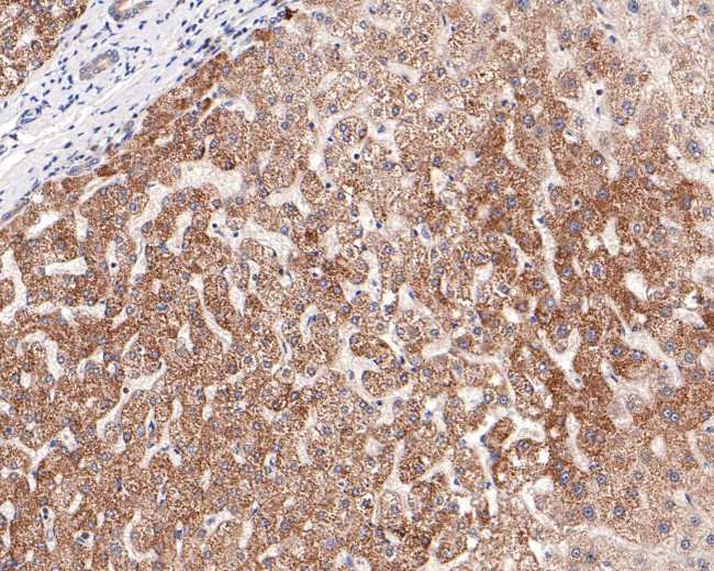 ITPK1 Antibody in Immunohistochemistry (Paraffin) (IHC (P))