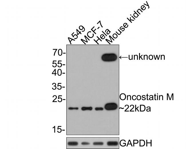 Oncostatin M Antibody in Western Blot (WB)