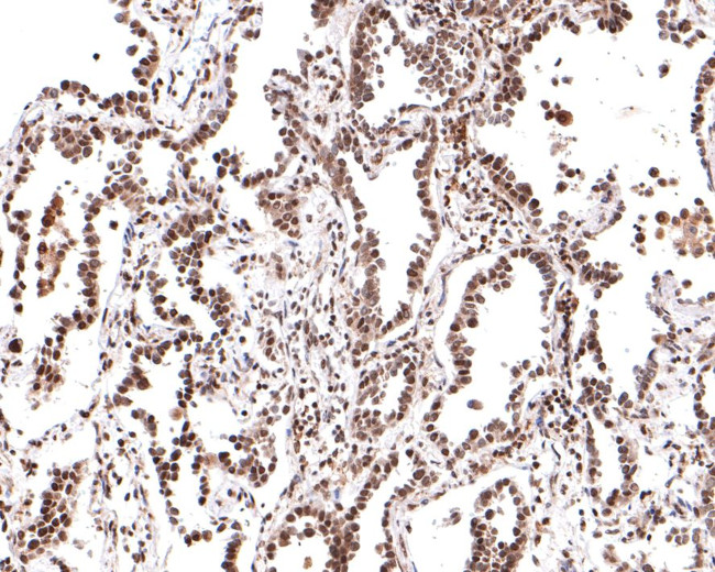 PER2 Antibody in Immunohistochemistry (Paraffin) (IHC (P))