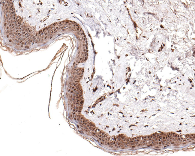 PER2 Antibody in Immunohistochemistry (Paraffin) (IHC (P))