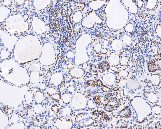 PIAS1 Antibody in Immunohistochemistry (Paraffin) (IHC (P))