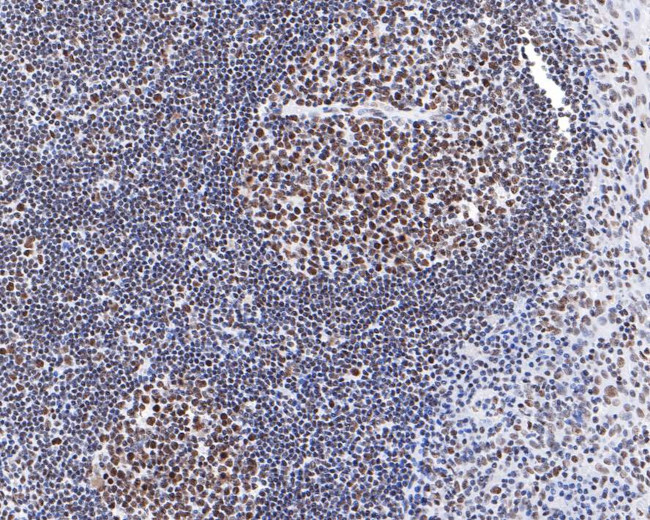 PIAS1 Antibody in Immunohistochemistry (Paraffin) (IHC (P))