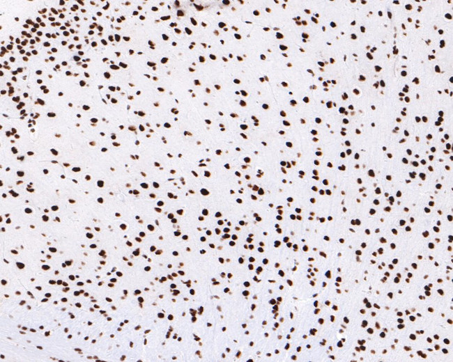 PIAS1 Antibody in Immunohistochemistry (Paraffin) (IHC (P))