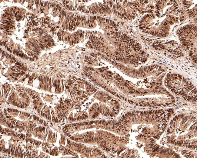 RSK2 Antibody in Immunohistochemistry (Paraffin) (IHC (P))