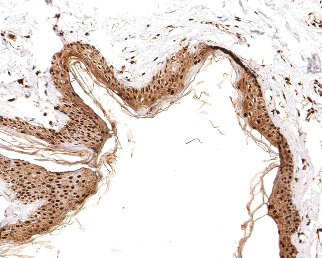 RSK2 Antibody in Immunohistochemistry (Paraffin) (IHC (P))