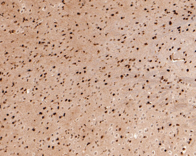 RSK2 Antibody in Immunohistochemistry (Paraffin) (IHC (P))