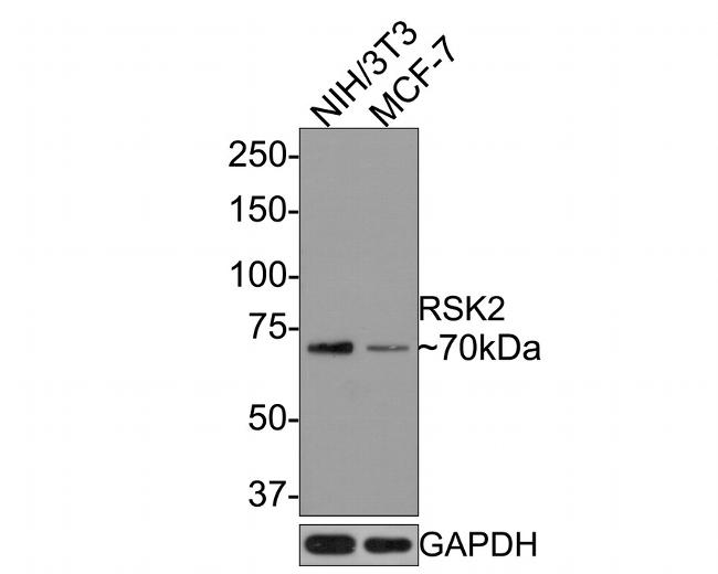 RSK2 Antibody in Western Blot (WB)