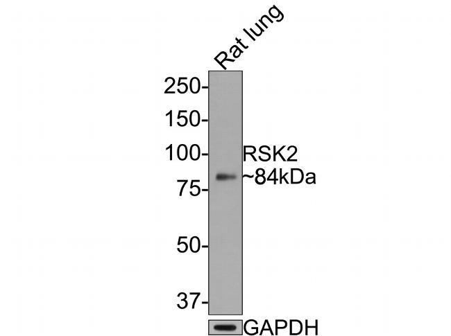 RSK2 Antibody in Western Blot (WB)