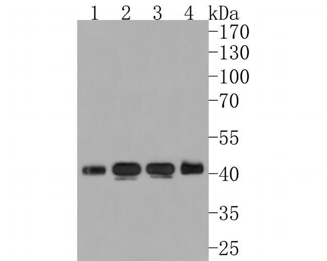 BCKDK Antibody in Western Blot (WB)