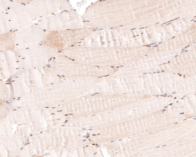 MEF2A/MEF2C Antibody in Immunohistochemistry (Paraffin) (IHC (P))