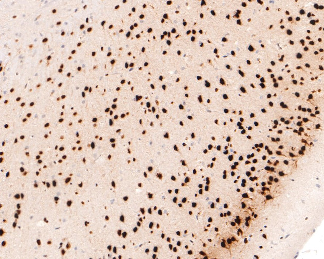 MEF2A/MEF2C Antibody in Immunohistochemistry (Paraffin) (IHC (P))