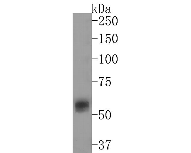 MEF2A/MEF2C Antibody in Western Blot (WB)