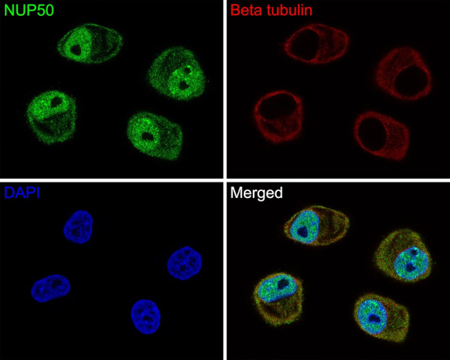 NUP50 Antibody in Immunocytochemistry (ICC/IF)