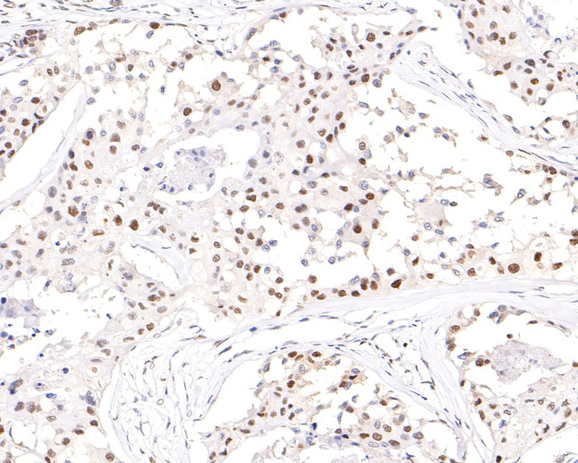 NUP50 Antibody in Immunohistochemistry (Paraffin) (IHC (P))