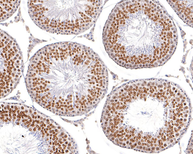 NUP50 Antibody in Immunohistochemistry (Paraffin) (IHC (P))