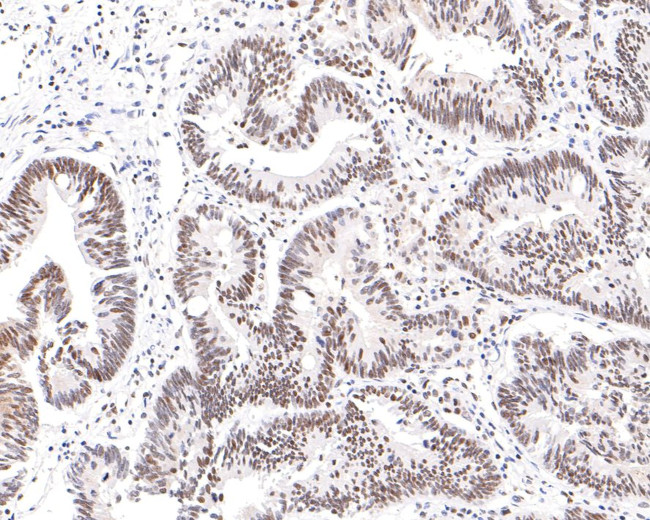 NUP50 Antibody in Immunohistochemistry (Paraffin) (IHC (P))