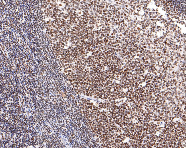 NUP50 Antibody in Immunohistochemistry (Paraffin) (IHC (P))