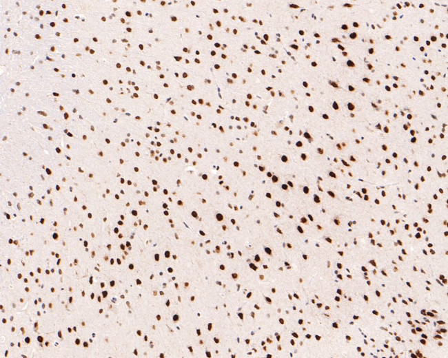 NUP50 Antibody in Immunohistochemistry (Paraffin) (IHC (P))