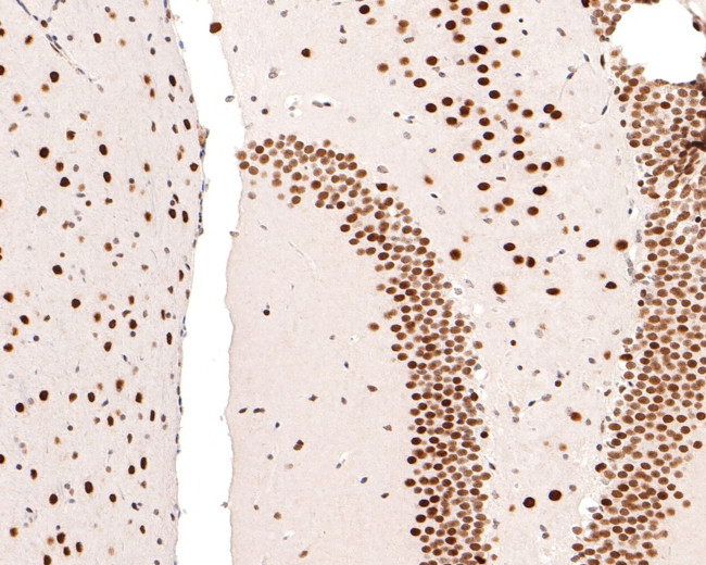 NUP50 Antibody in Immunohistochemistry (Paraffin) (IHC (P))