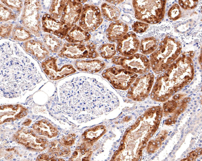 Napsin A Antibody in Immunohistochemistry (Paraffin) (IHC (P))