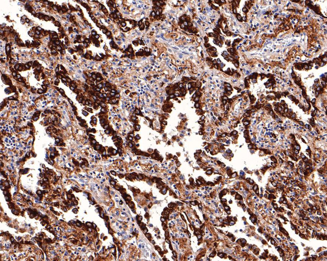 Napsin A Antibody in Immunohistochemistry (Paraffin) (IHC (P))