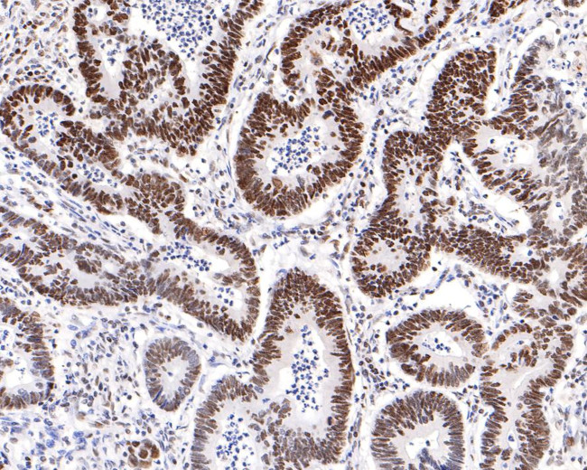 AKAP8 Antibody in Immunohistochemistry (Paraffin) (IHC (P))