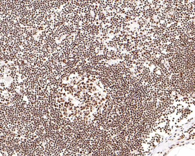 AKAP8 Antibody in Immunohistochemistry (Paraffin) (IHC (P))