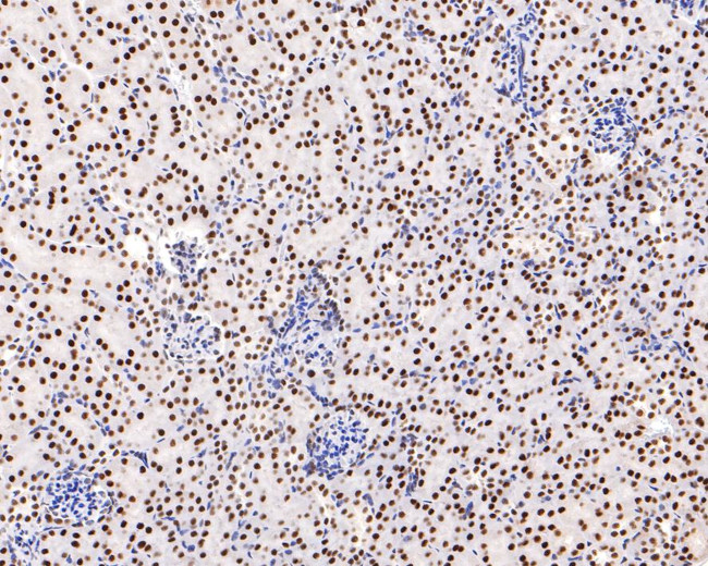 AKAP8 Antibody in Immunohistochemistry (Paraffin) (IHC (P))