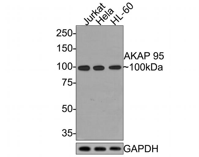 AKAP8 Antibody in Western Blot (WB)