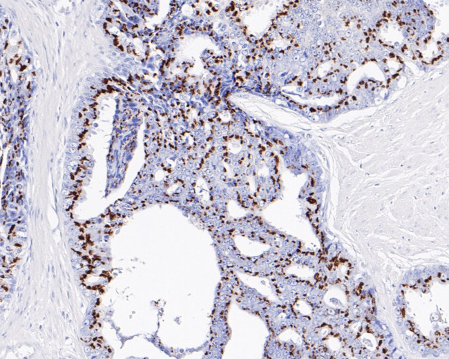 Prostein Antibody in Immunohistochemistry (Paraffin) (IHC (P))