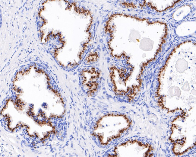 Prostein Antibody in Immunohistochemistry (Paraffin) (IHC (P))