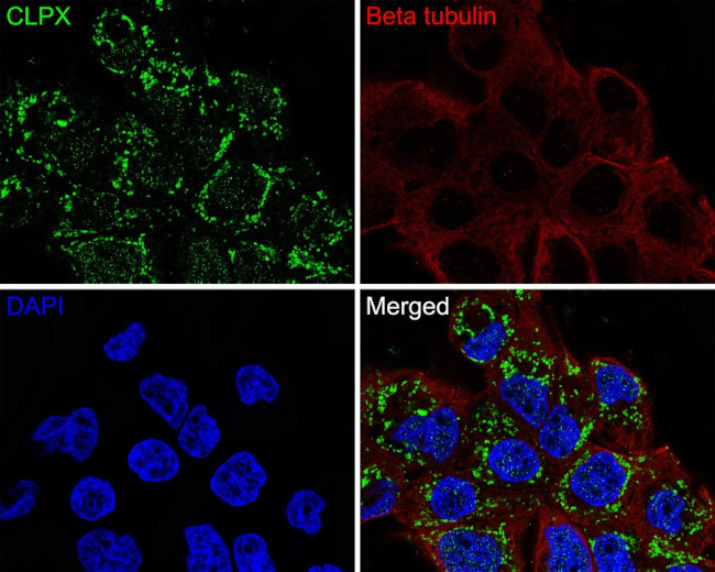 CLPX Antibody in Immunocytochemistry (ICC/IF)