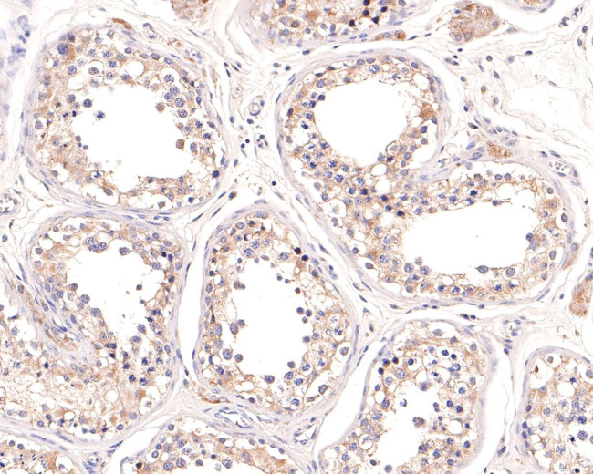 CLPX Antibody in Immunohistochemistry (Paraffin) (IHC (P))