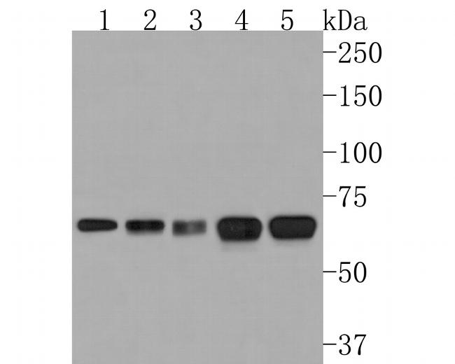 CLPX Antibody in Western Blot (WB)